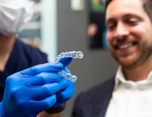 How to Care for Your Retainers