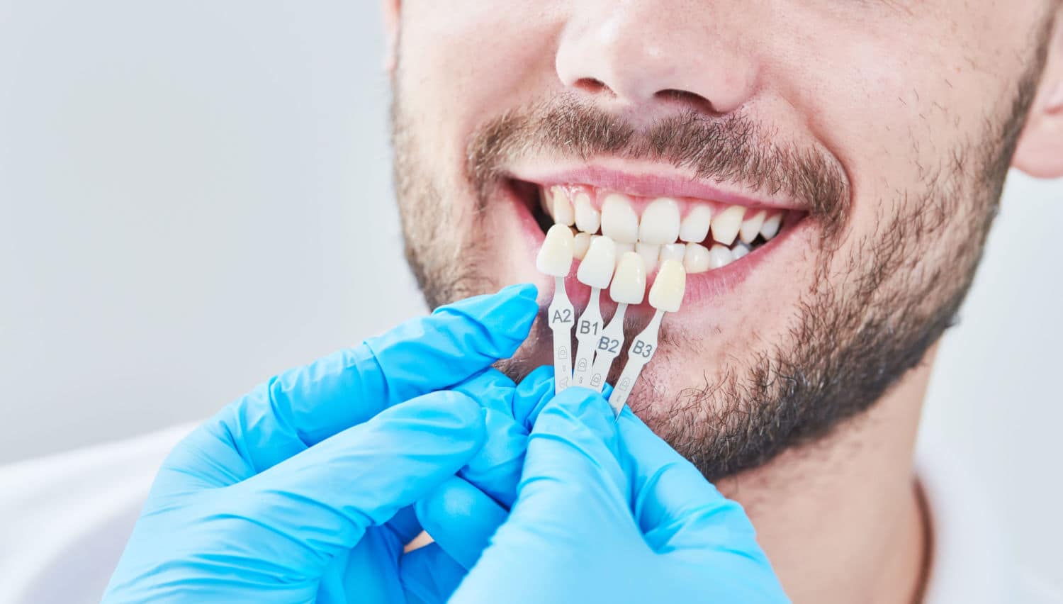 # Types of Cosmetic Dental Restorations