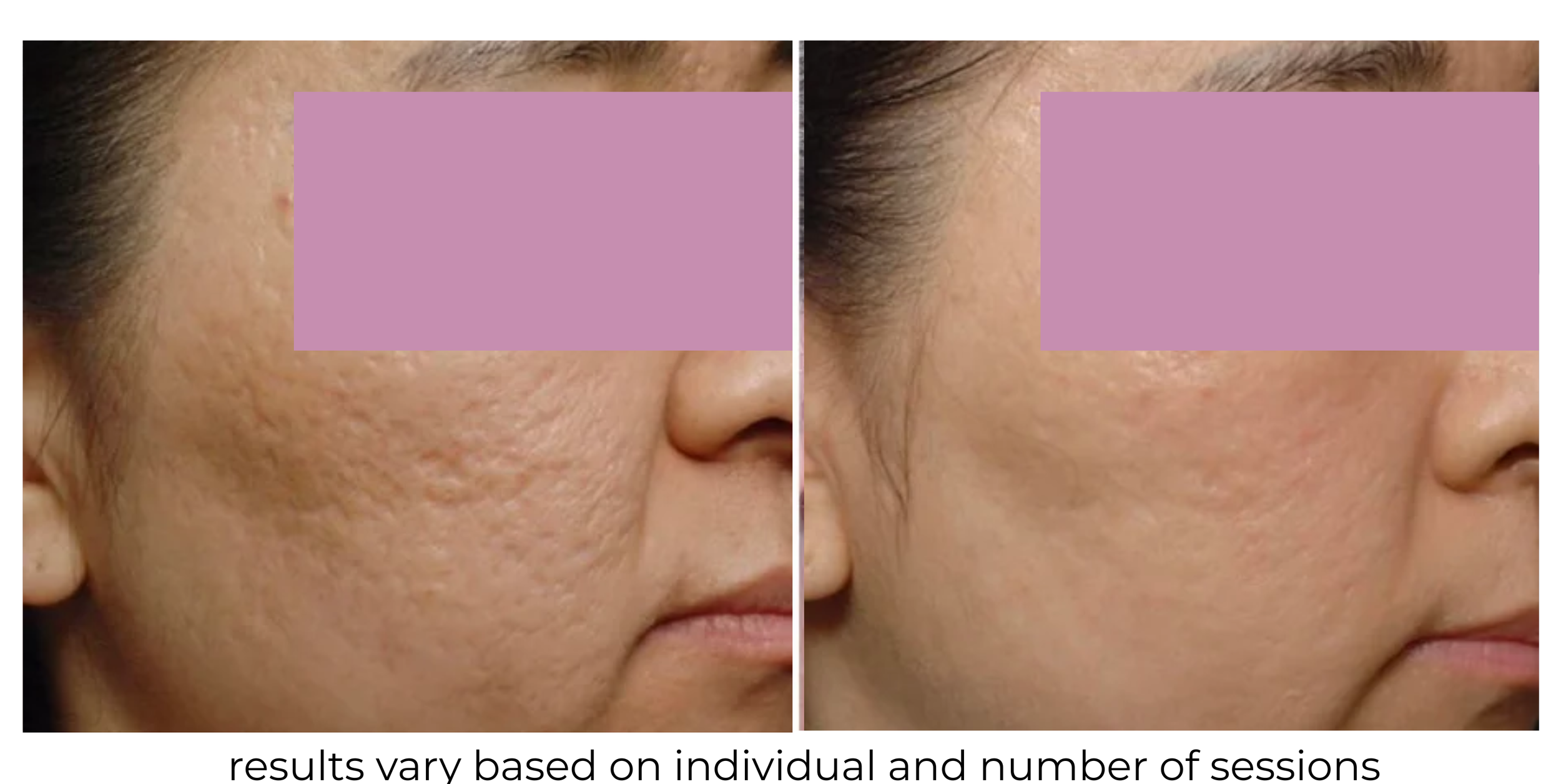 The Impact of Dermatology on Overall Skin Health