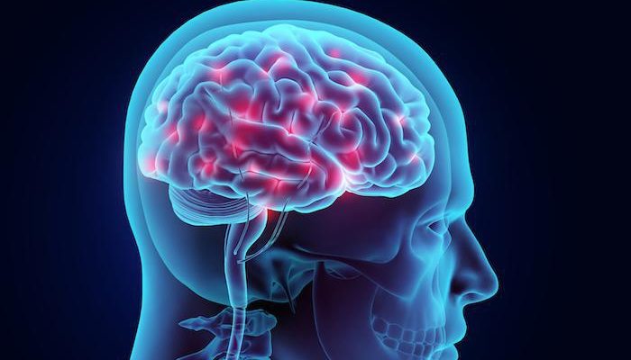 The Connection Between Brain Surgery and Epilepsy Treatment